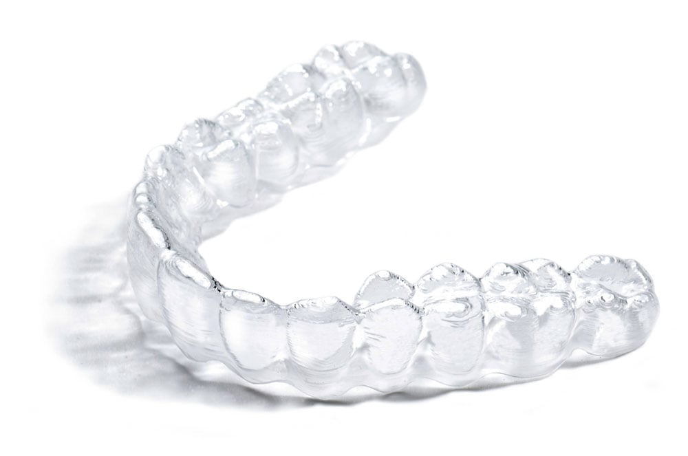 Invisible Braces in Lyndhurst, OH